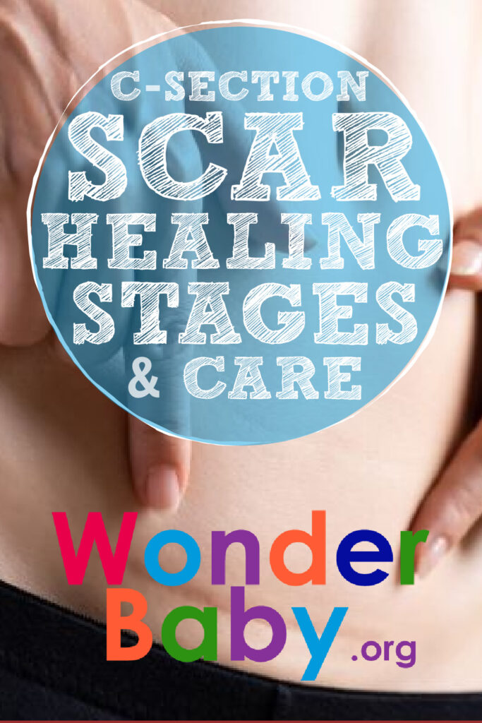 C-Section Scar Healing Stages and Care