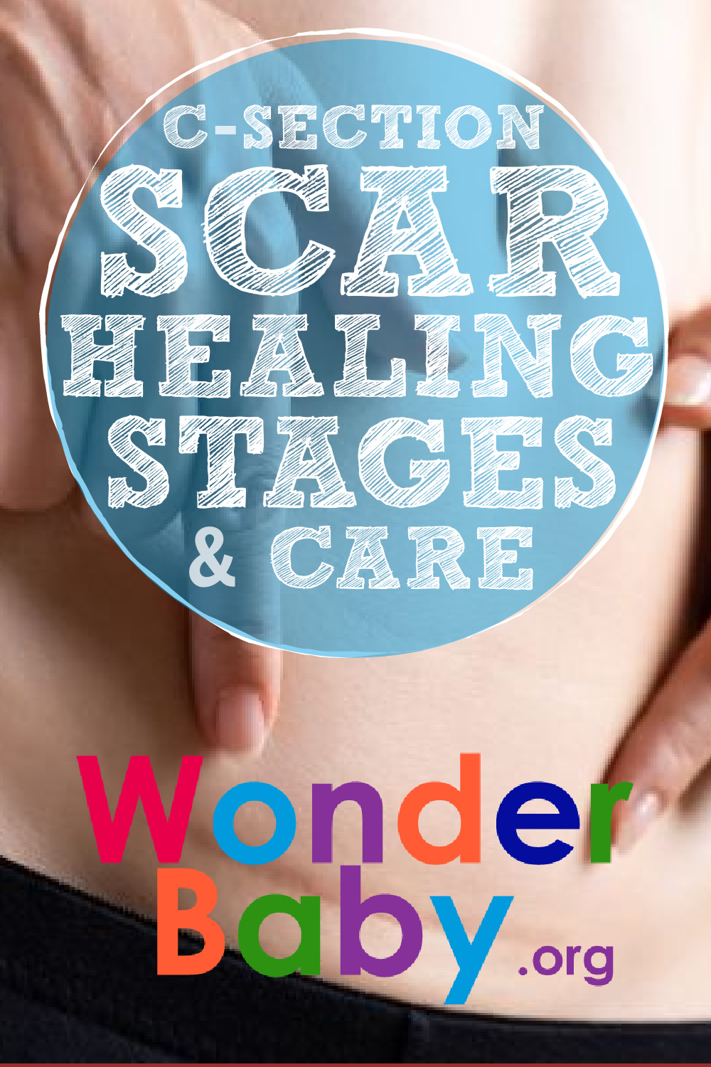 scar-tissue-caused-by-c-section-at-richard-king-blog