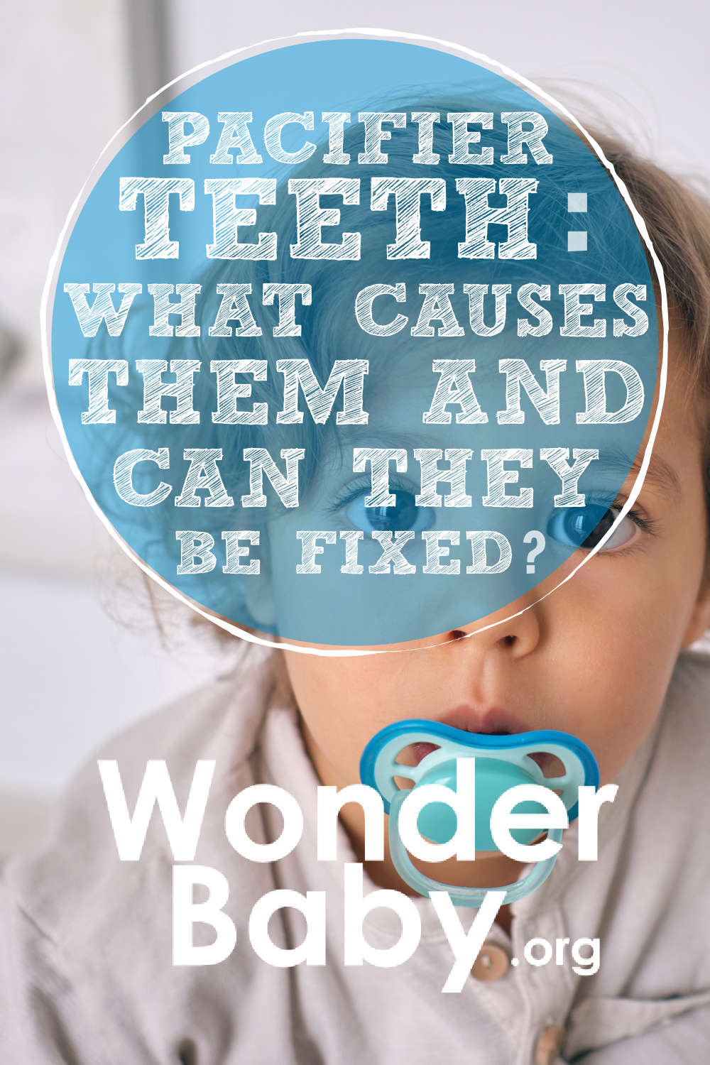 Pacifier Teeth What Causes Them and Can They Be Fixed?