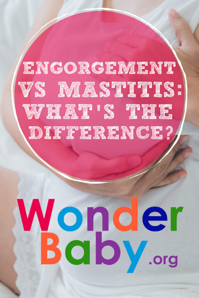 Mastitis and breast engorgement are painful. Wearing right support