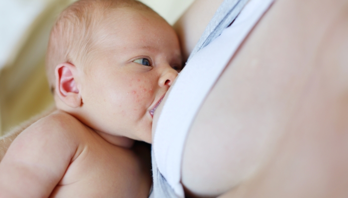 Does Treating Baby Acne With Breast Milk Work?