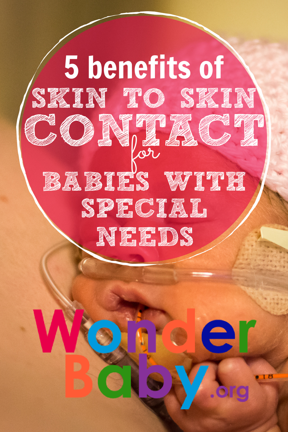 5-benefits-of-skin-to-skin-contact-for-babies-with-special-needs