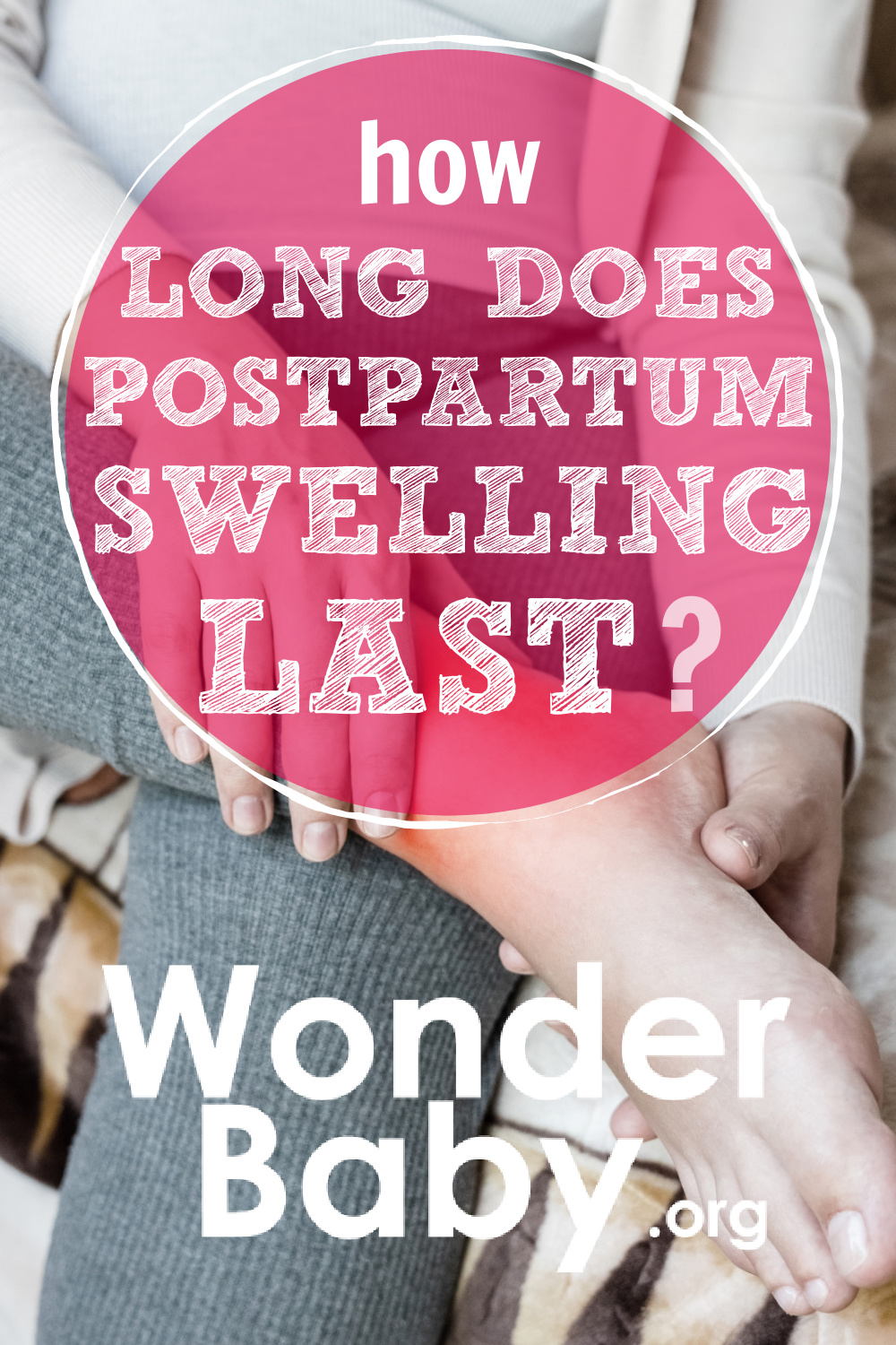 how-long-does-postpartum-swelling-last-wonderbaby