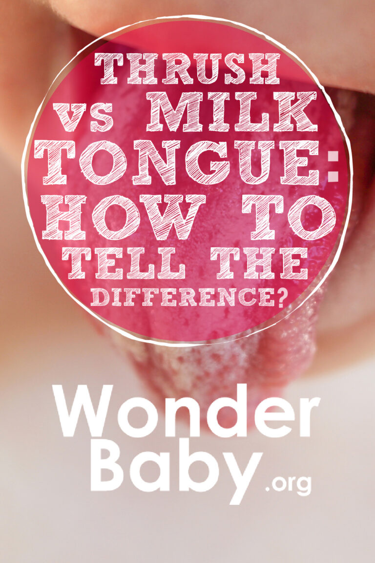 Thrush vs Milk Tongue: How to Tell the Difference | WonderBaby.org