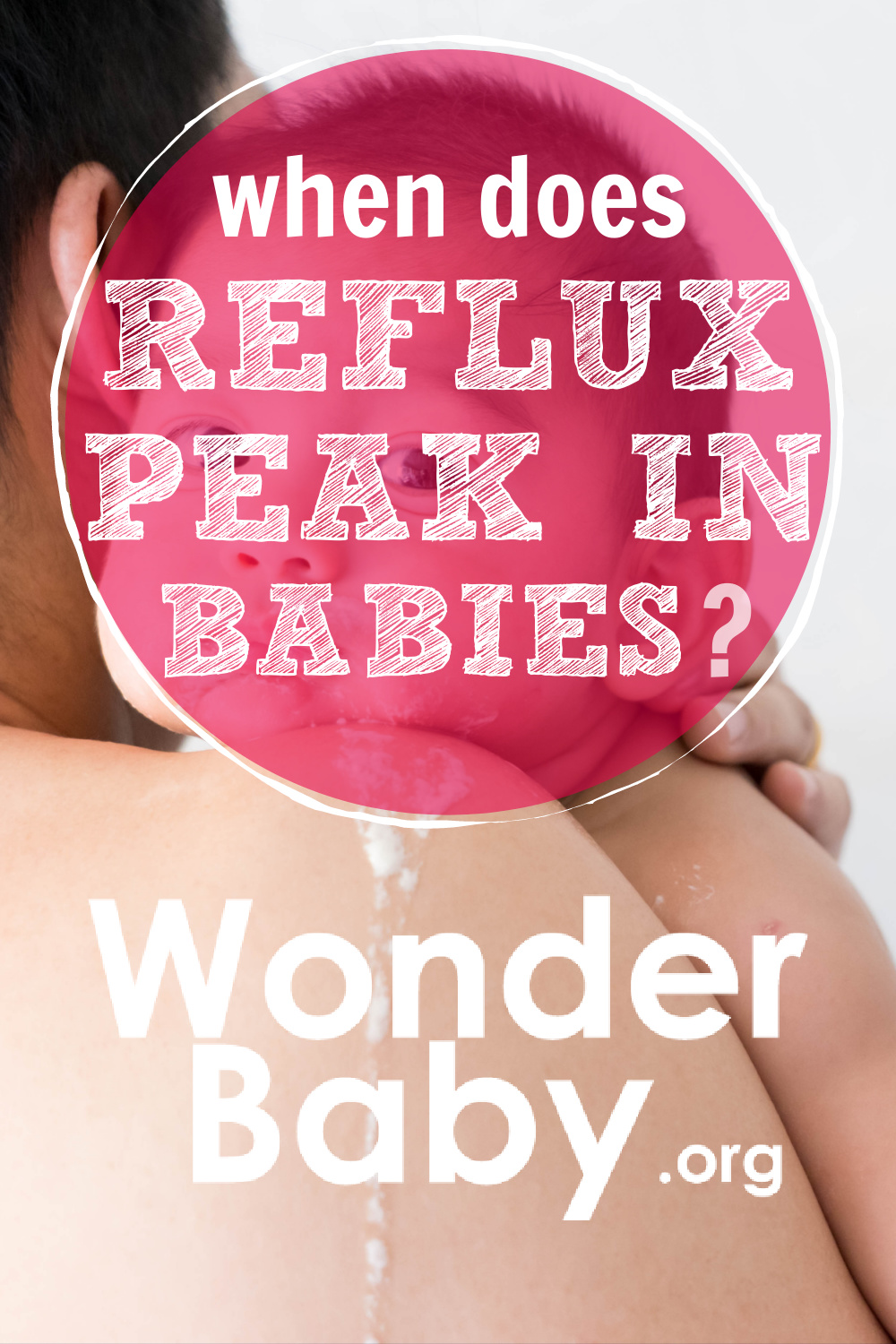 when-does-reflux-peak-in-babies-wonderbaby